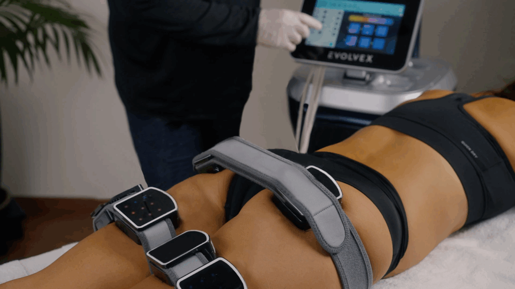 Tratamiento estético EvolveX Transform para cómo eliminar la celulitis
