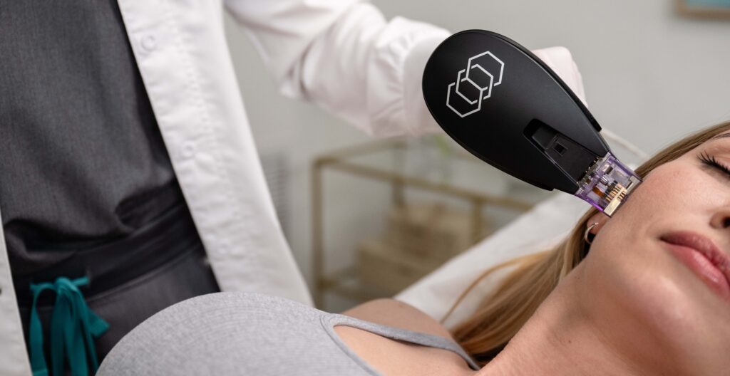 ¿Qué es la radiofrecuencia bipolar?