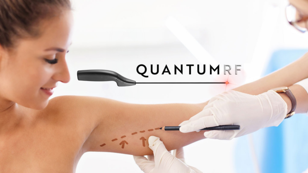 QuantumRF vs Braquioplastia