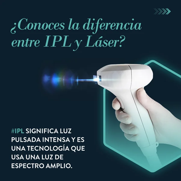 diferencia entre láser e IPL