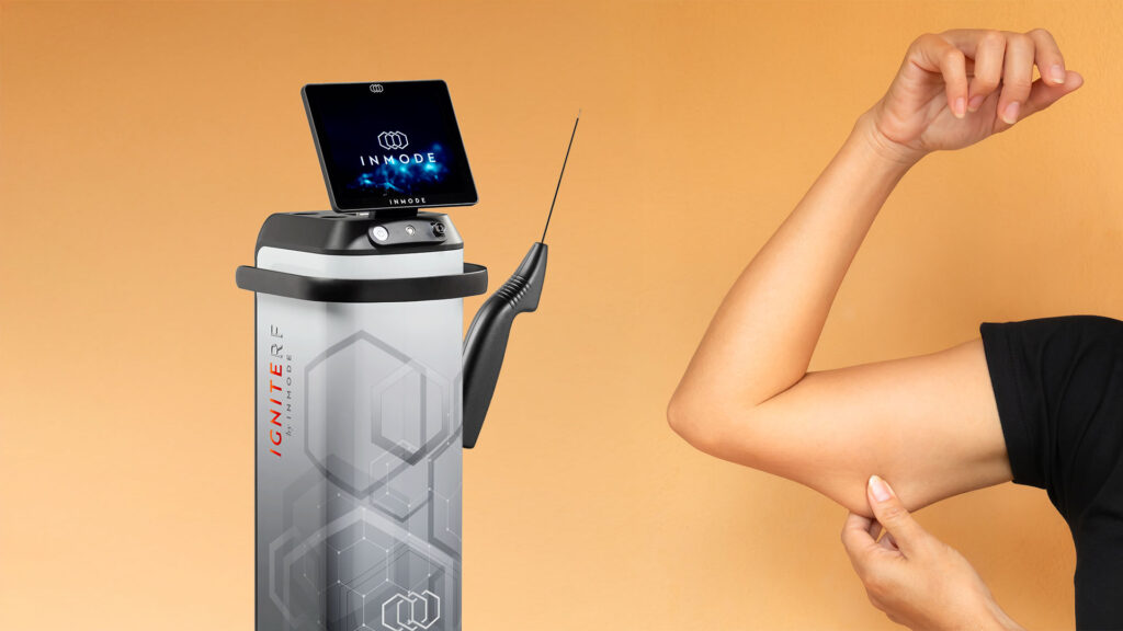 QuantumRF para retracción cutánea en brazos y abdomen de alta precisión